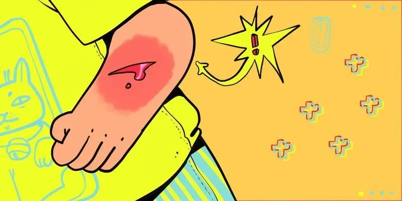 Что такое рожистое воспаление и как его лечить