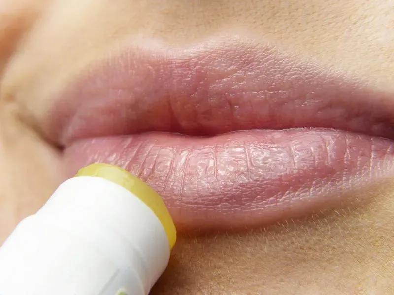 Как избавиться от трещин на губах