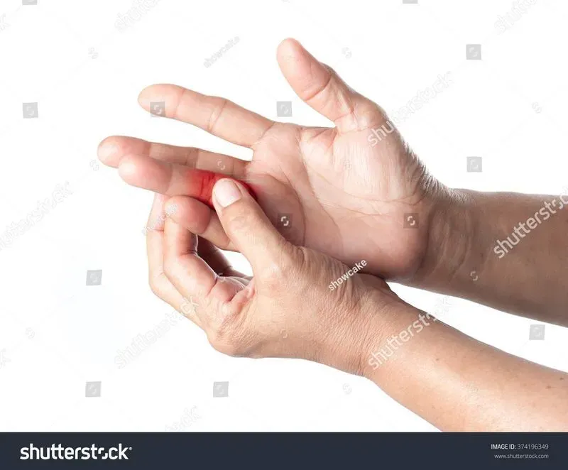 Почему болит большой палец на правой руке