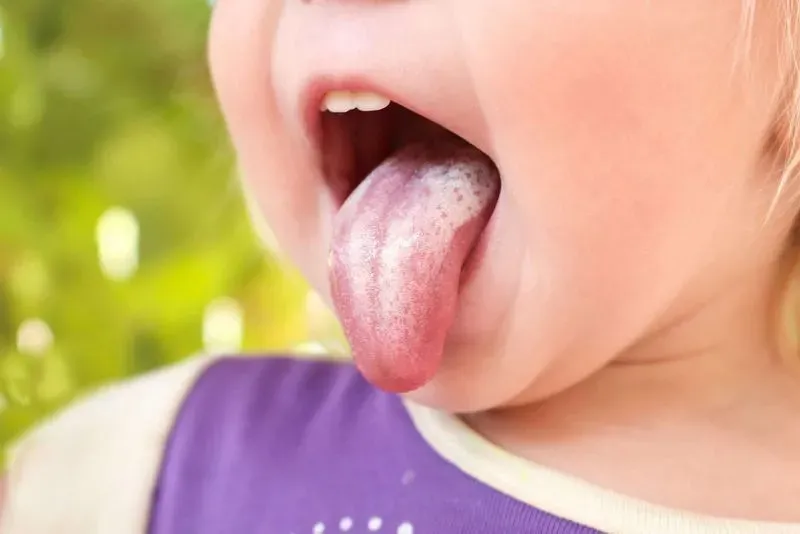 Чем лечить стоматит у детей во рту в домашних