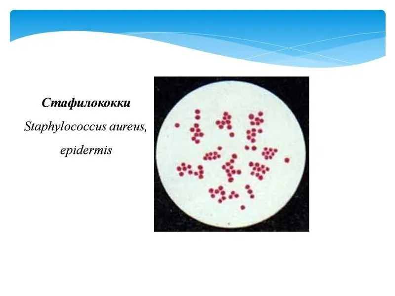 Staphylococcus aureus перевод