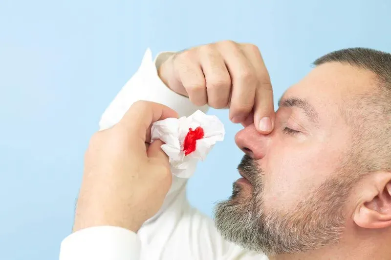 Из за чего может идти кровь из носа каждый день с одной ноздри