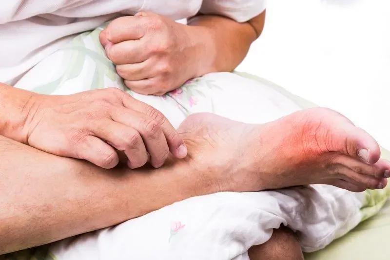 Артрит ноги симптомы и лечение