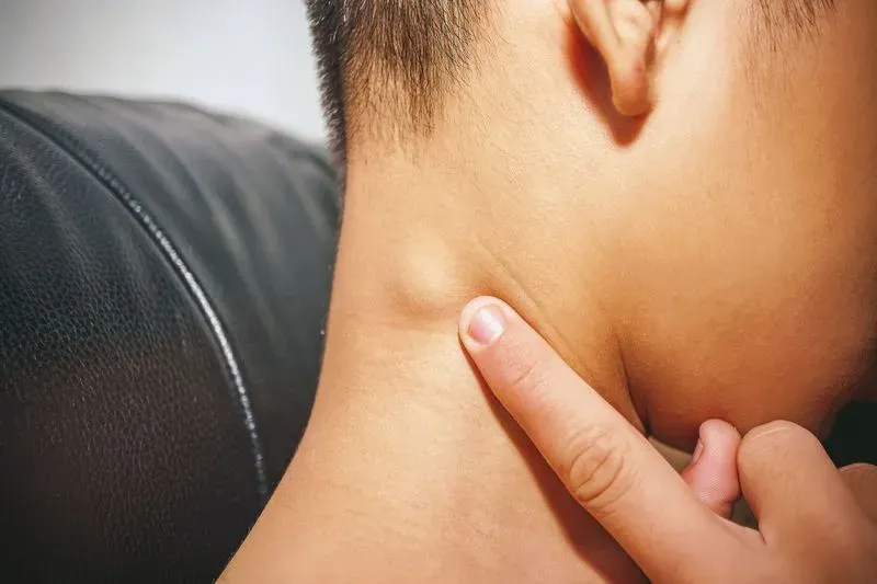 Воспаление лимфоузлов на шее при орви