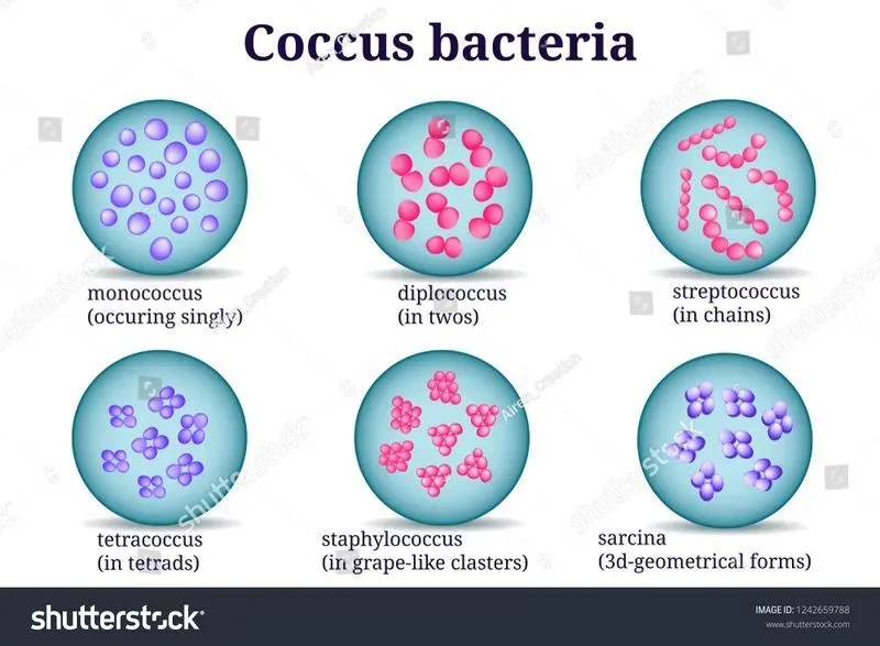 Лактобактерии не обнаружены в мазке