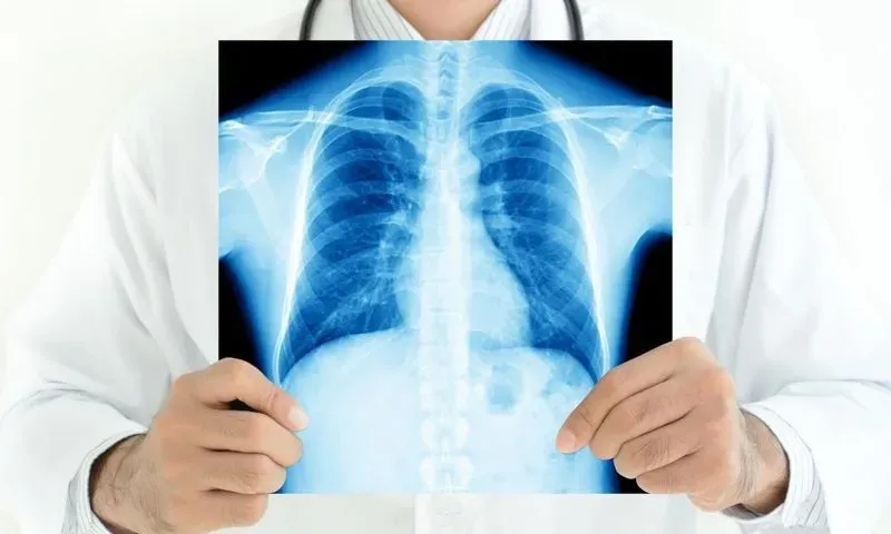 Туберкулез как диагностируют