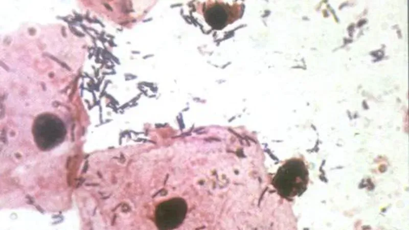Трихомонада в мазке под микроскопом фото