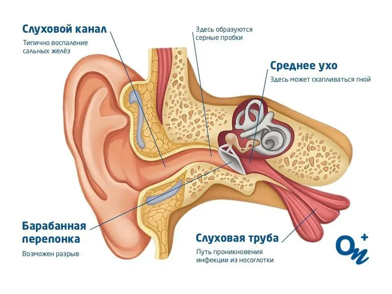 Лечение при отите среднего уха у взрослого человека