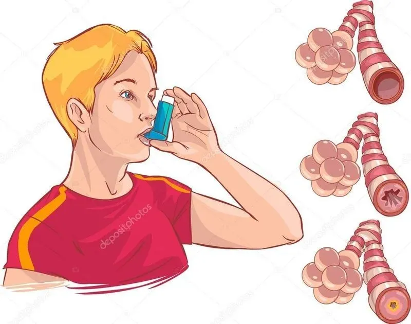 Приступы астма