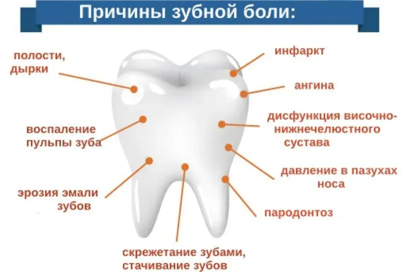 При надавливании болит зуб с временной пломбой